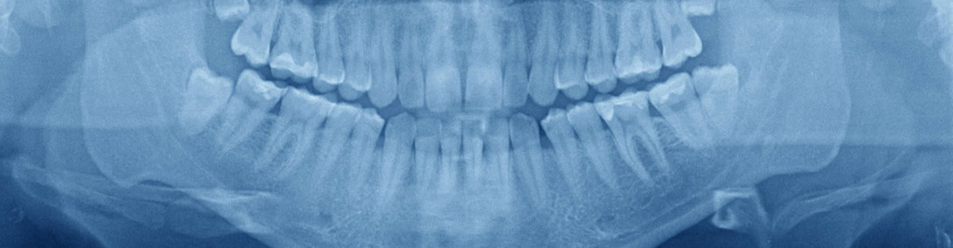 smiling patient