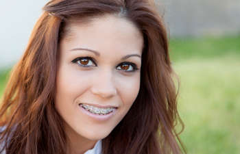 young woman with braces