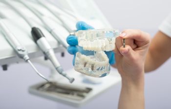 dentist checking dental implants